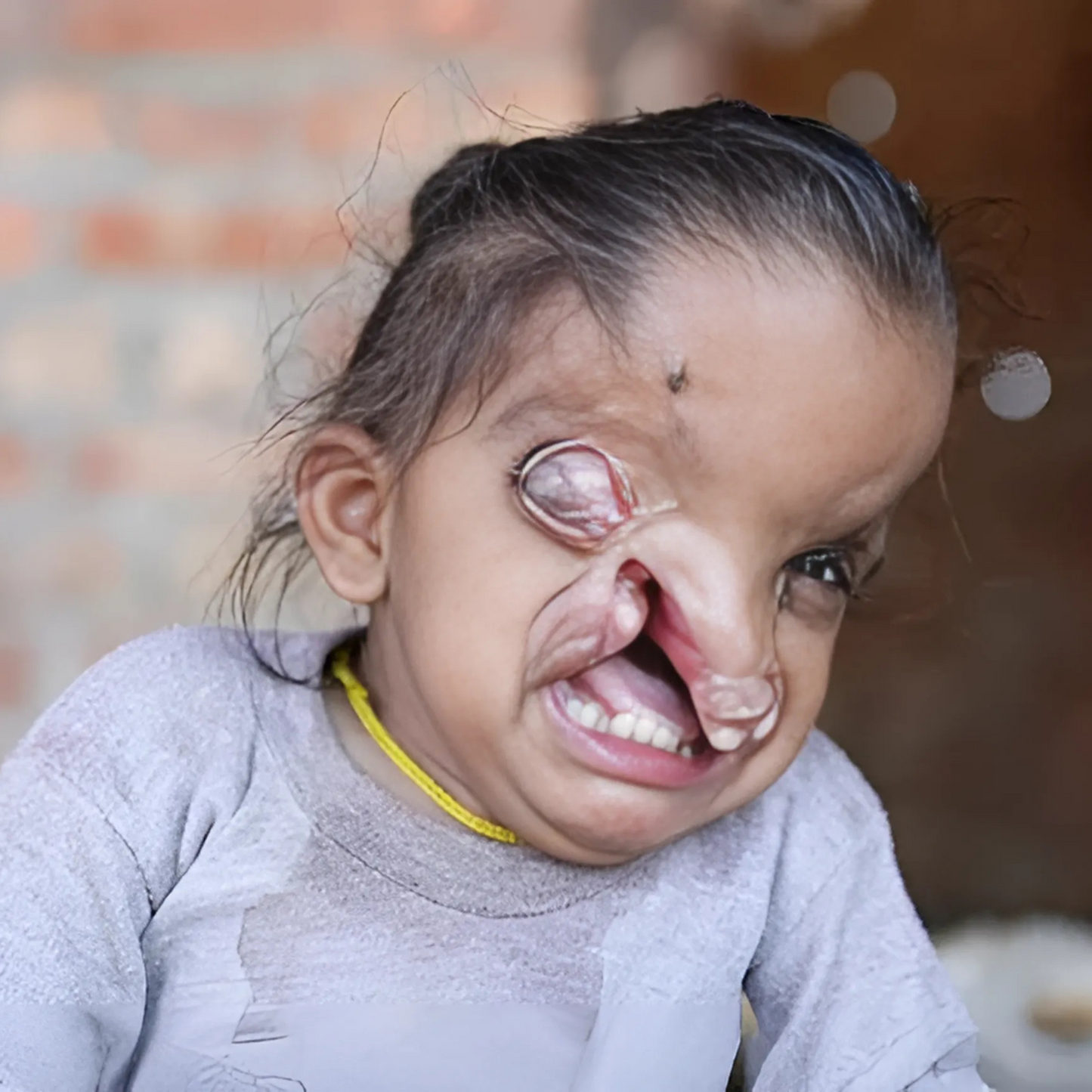 Please help! My own family asks me to abandon my son but I refuse to!